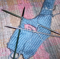 stitches
