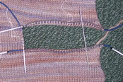 stitches